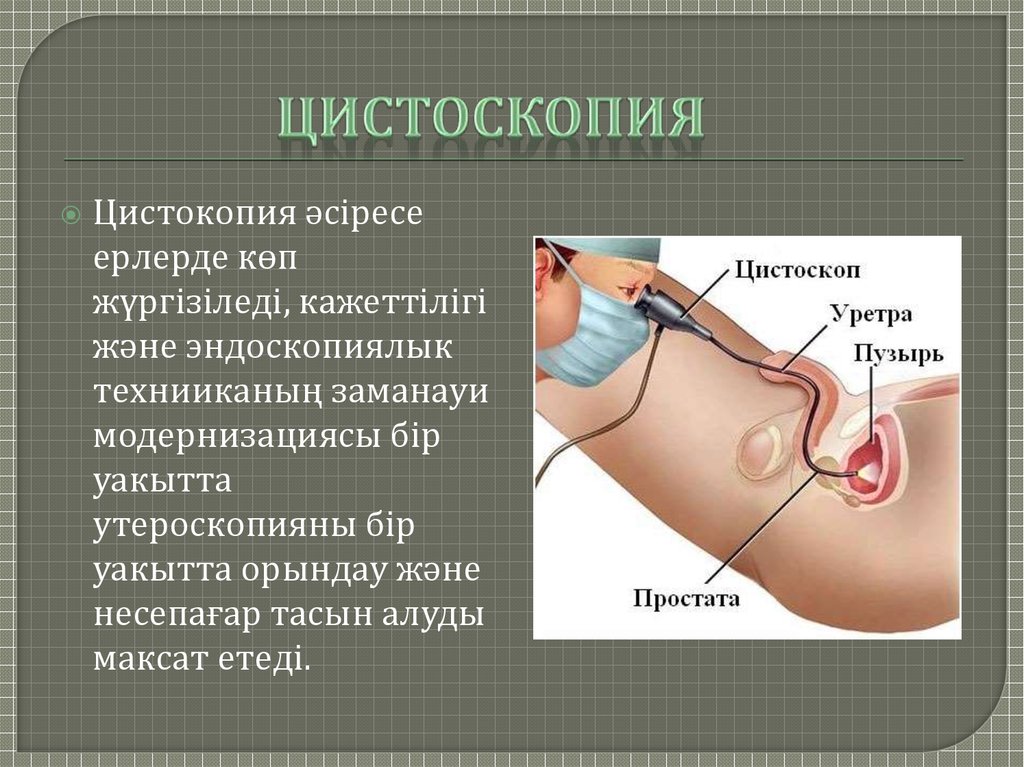 Можно Ли Заниматься Сексом После Цистоскопии