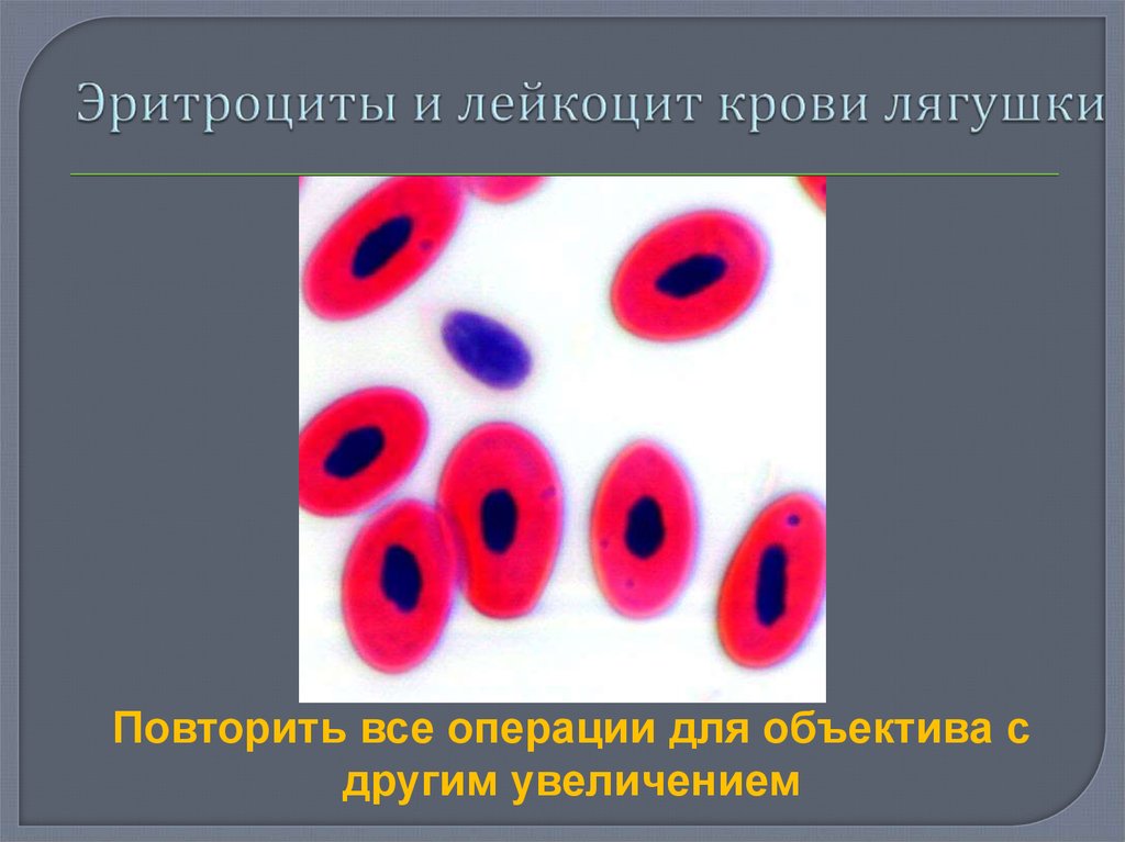 Эритроциты и лейкоцит крови лягушки