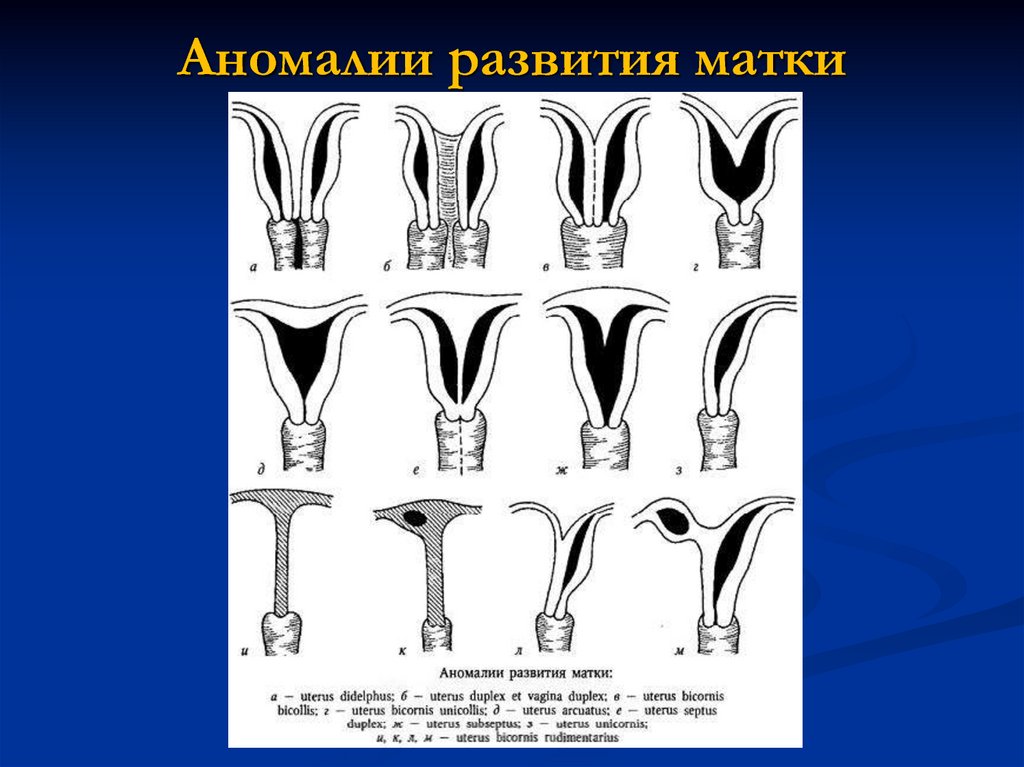 Аномалия развития и положения женских органов презентация