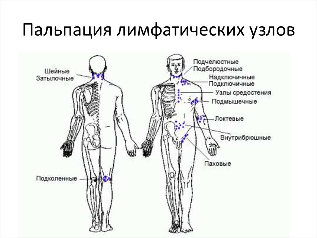 Где в паху у женщин находятся лимфоузлы фото у женщин