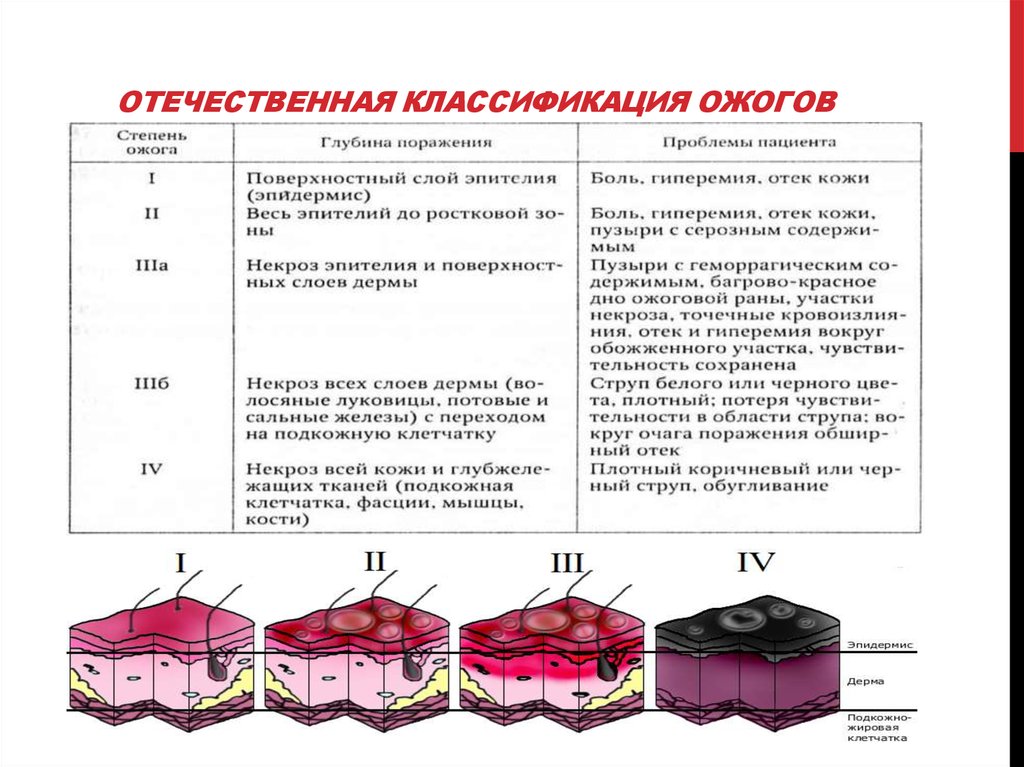 Понятие основные виды и степени ожогов презентация