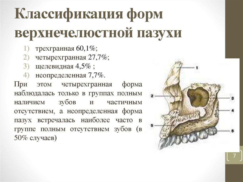 Правая верхнечелюстная пазуха где находится картинка