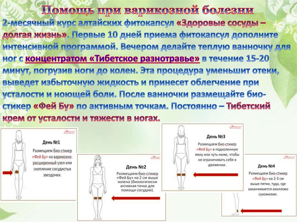 Помощь При Варикозе