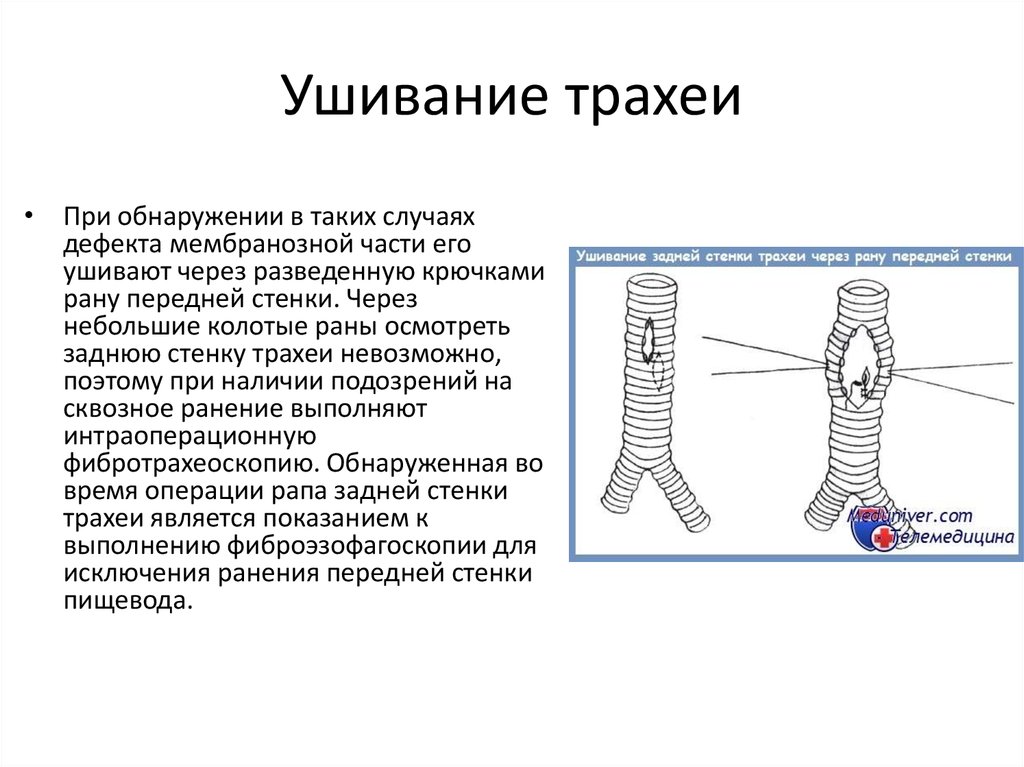 Отец Изначально Трахеи Порно Дочь Деревянко Русский