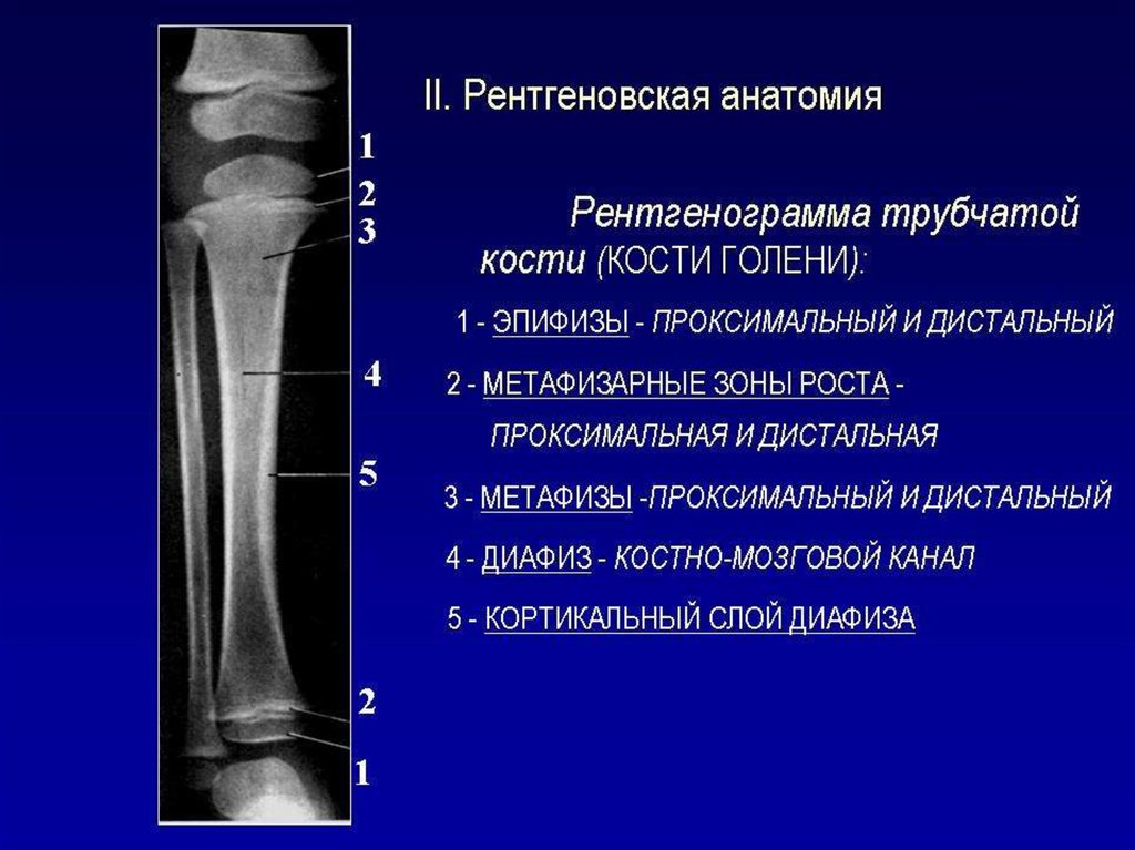 Схема длинной трубчатой кости взрослого человека и ребенка рентген