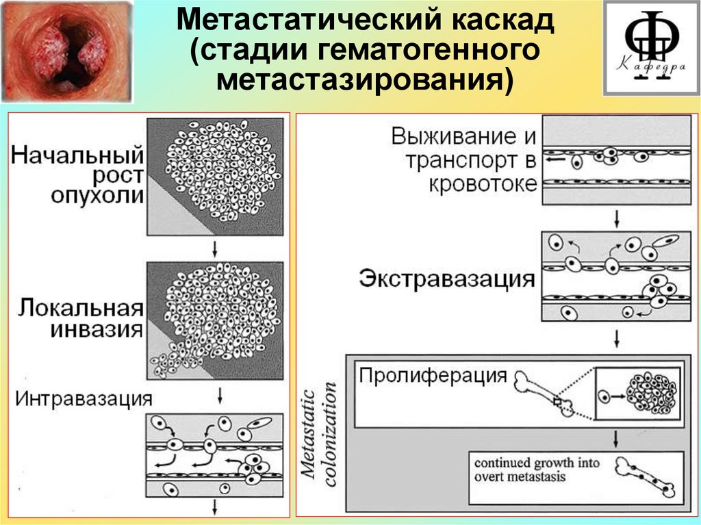 Патофизиология опухолевого роста презентация