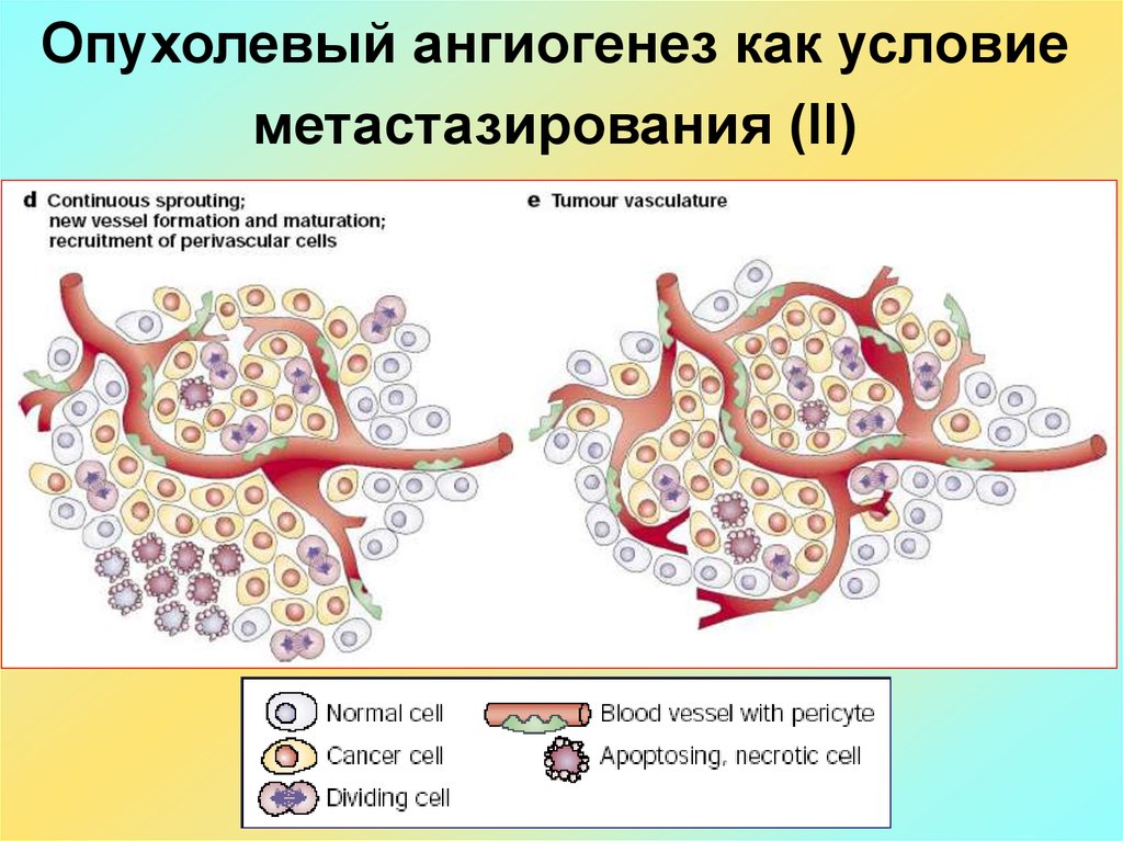 Опухолевый рост. Ангиогенез патофизиология. Опухолевый ангиогенез. Опухоль патофизиология. Факторы опухолевого ангиогенеза.