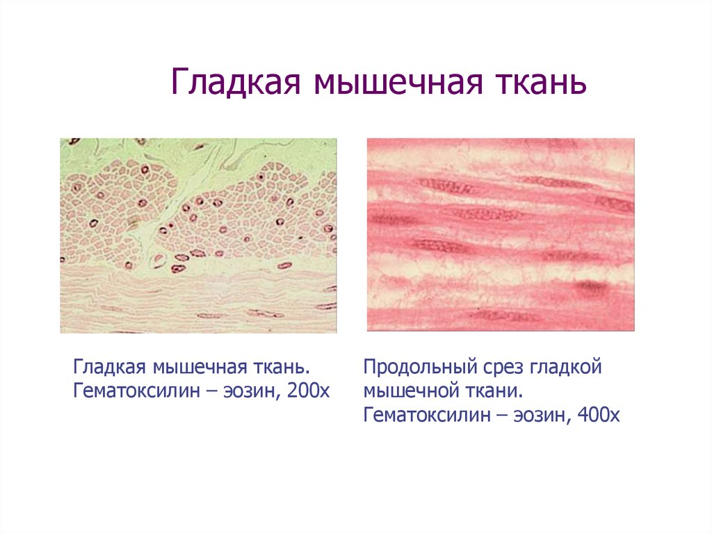 Изображенная на рисунке ткань является основой скелета гладких мышц