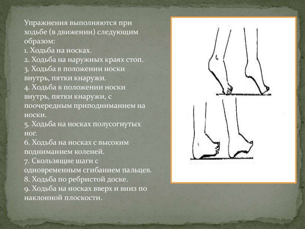 Почему человек ходит на носочках. ЛФК для продольного плоскостопия. Вальгус плоскостопие упражнения. Ходьба на носочках при плоскостопии. Хождение на носочках при плоскостопии.
