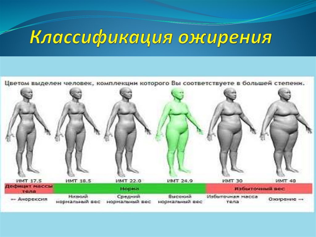 Сколько откладывается жир. Классификация ожирения. Типы ожирения классификация. Ожирение 1 степени. Типы ожирения у женщин.