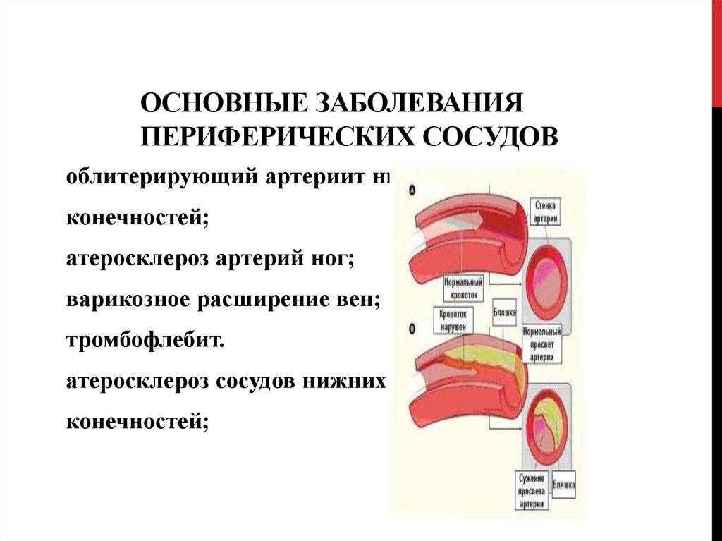 Заболевания артерий вен