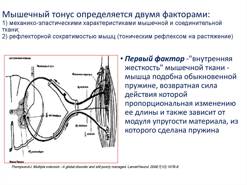 Мышечный тонус презентация