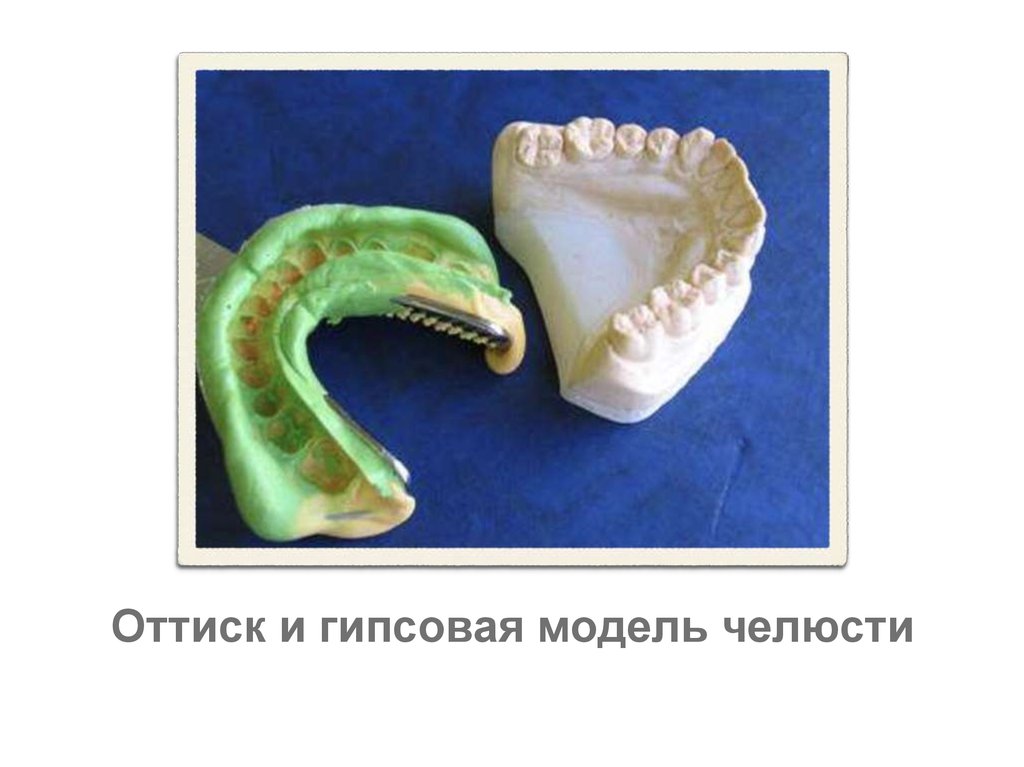 Оттискные материалы в ортопедической стоматологии презентация