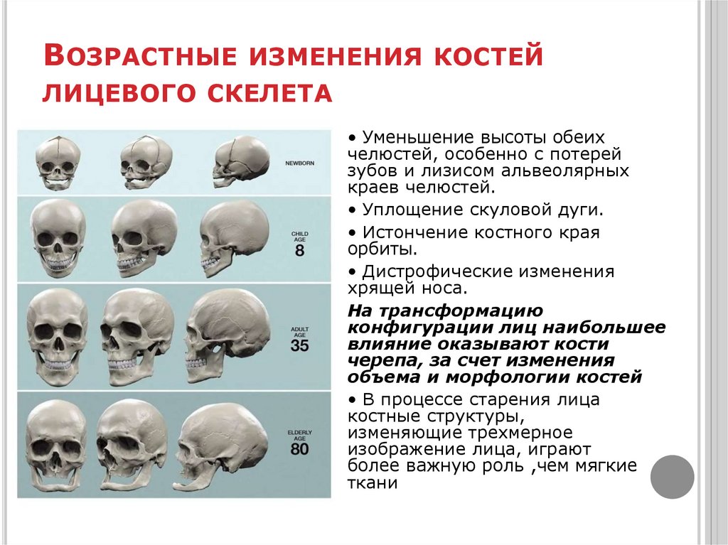 Возрастные изменения костей лицевого скелета