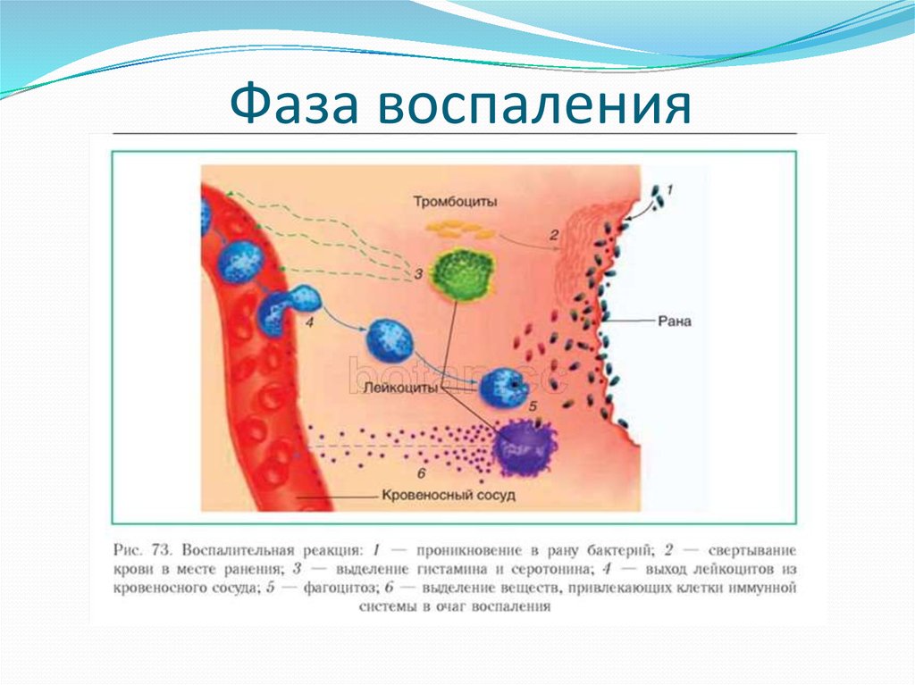 Воспалительный процесс. Фаза воспаления в раневом процессе. Фазы воспаления механизм развития. 3 Фаза воспаления в раневом процессе. Фаза экссудации воспаления.