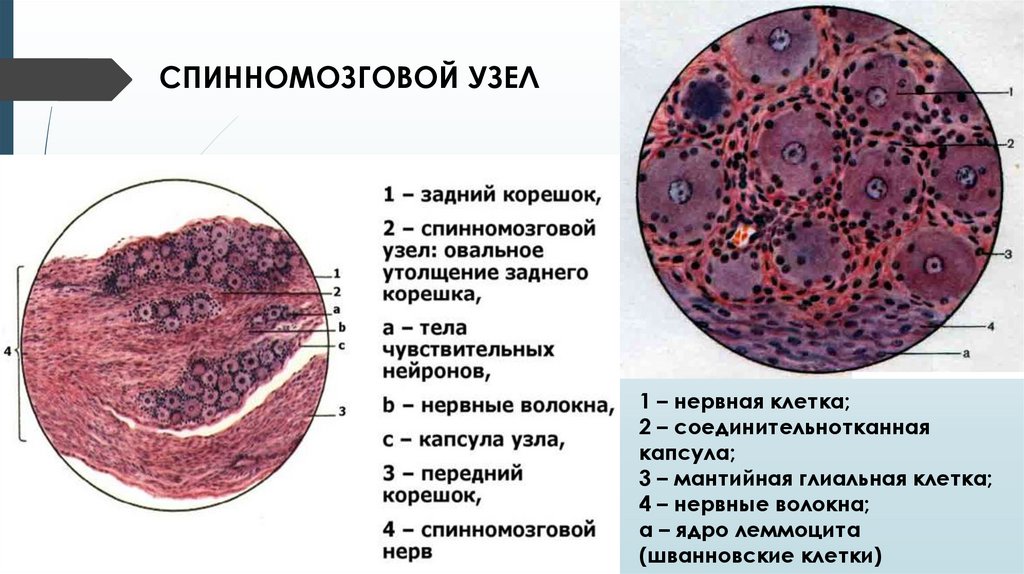 Узелки клеток. Спинномозговой узел окраска гематоксилин-эозином. Спинальный ганглий гистология. Гистологический препарат спинномозгового узла. Спинномозговой ганглий гистология.