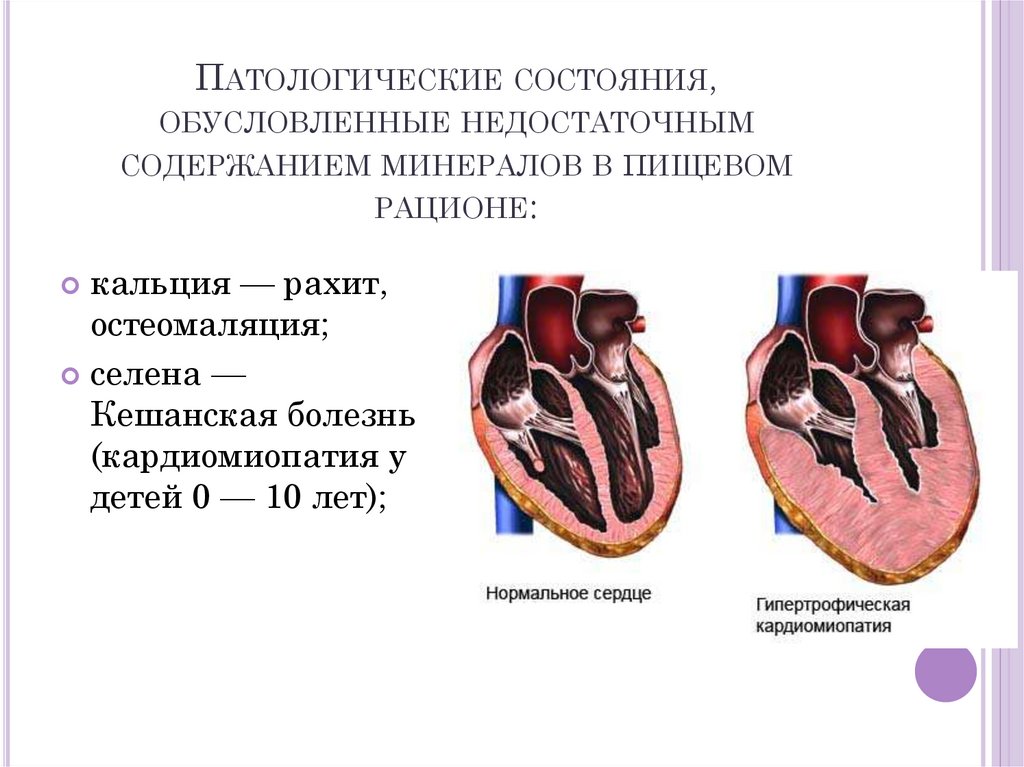 Основными причинами алиментарной белковой недостаточности являются:.