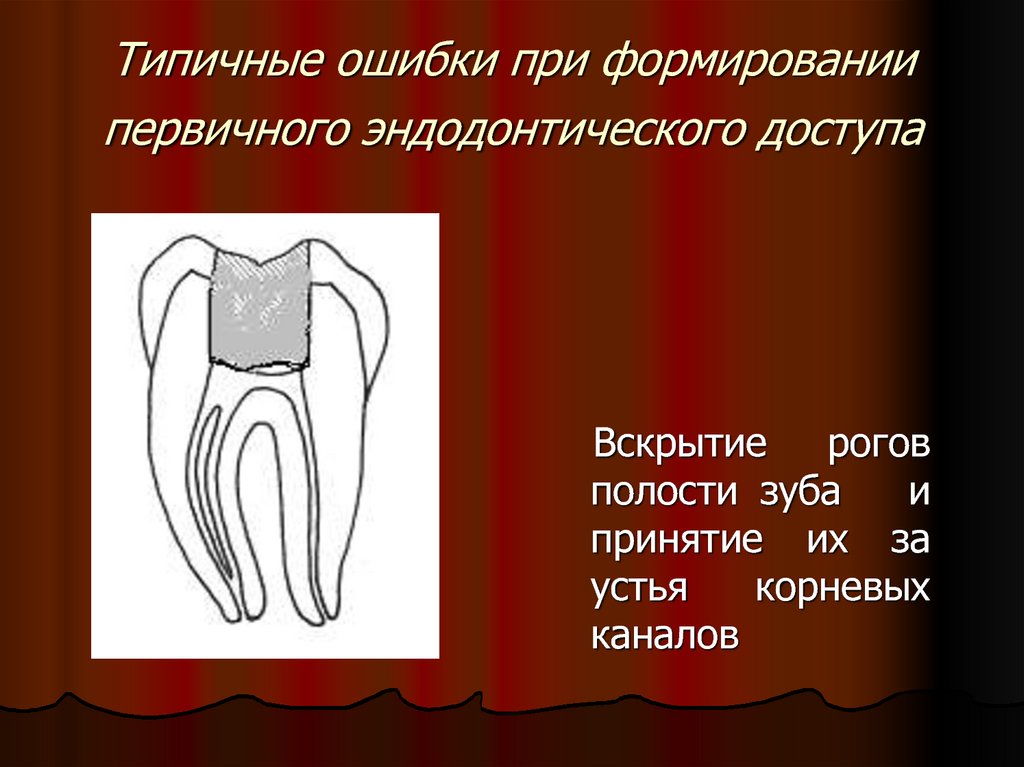 Осложнения эндодонтического лечения. Формирование эндодонтического доступа. Этапы раскрытия полости зуба. Перфорация стенки полости зуба. Вскрытие полости зуба эндодонтия.