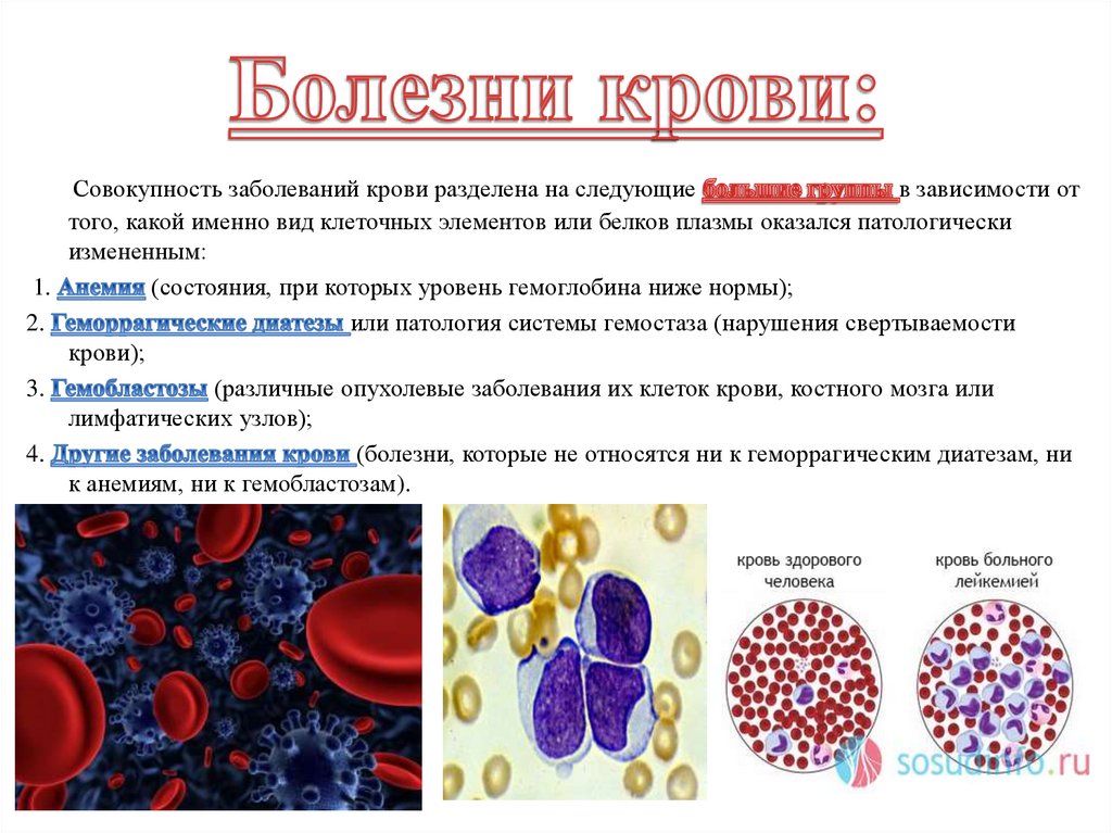История болезни крови. Болезни системы кроветворения. Заболевания крови и кроветворных органов.
