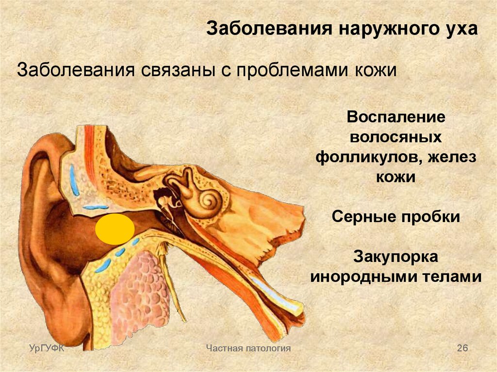 Нарушение среднего уха. Невоспалительные заболевания наружного уха. Заболевании наружного уха оториноларингология. Заболевания ушей снаружи. Классификация заболеваний наружного уха.