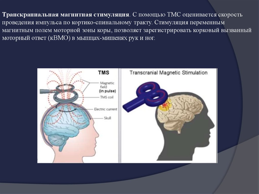 Магнитная стимуляция. Транскраниальная магнитная стимуляция (ТМС). Транскраниальная магнитная стимуляция\ схема. Транскраниальная стимуляция переменным током. Транскраниальная магнитная стимуляция презентация.