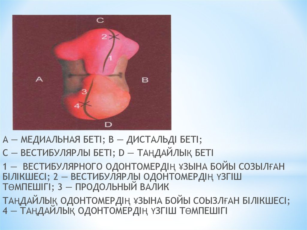 Медиальная дислокация. Медиальная петля. Медиальная петля капсула. Медиальная сторона валика. Медиальная консоль на имплантате.