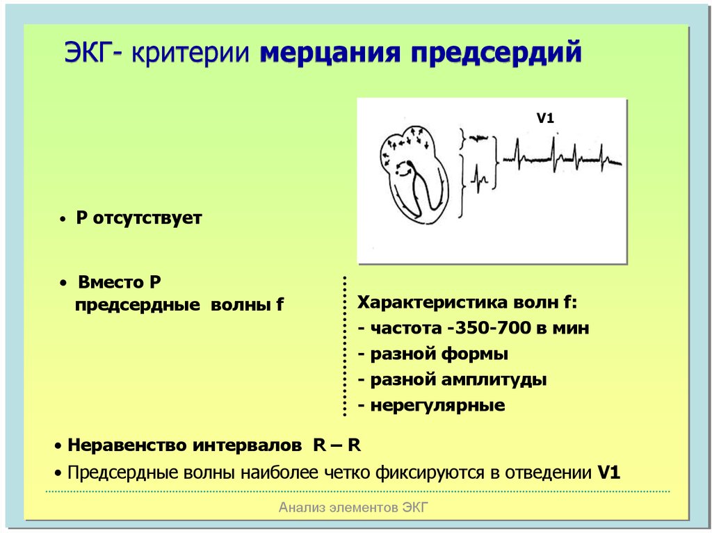 Мерцание на экг. ЭКГ для врача общей практики. ЭКГ критерии для подтверждения мерцания предсердий. Констриктивный перикардит ЭКГ. При ма предсердий частота волн f.