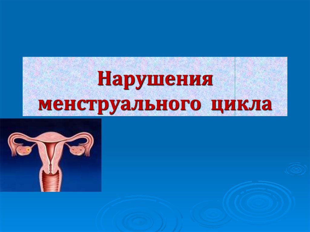 Презентация нарушения менструационного цикла