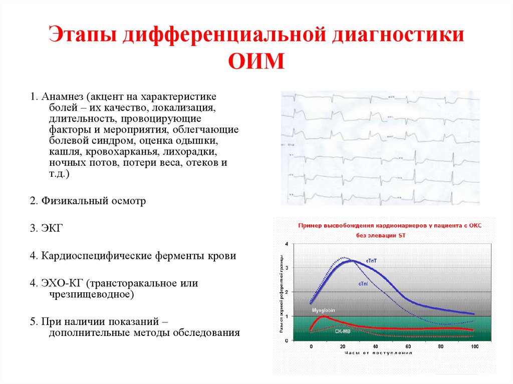 Этапы дифференциальной диагностики ОИМ