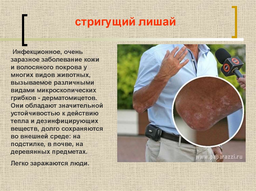 стригущий лишай