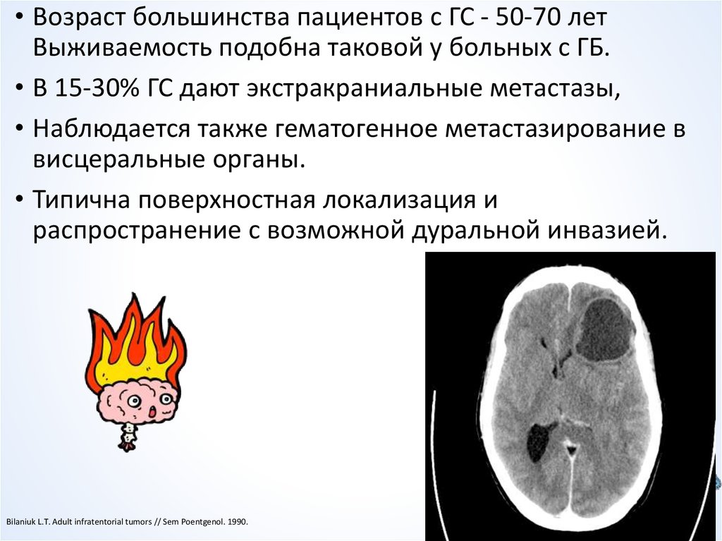 Опухоль головного мозга презентация