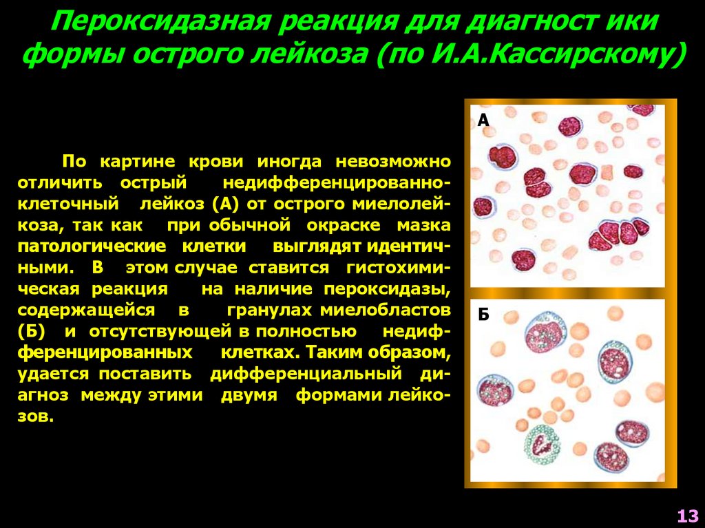 Лейкозы лейкемоидные реакции