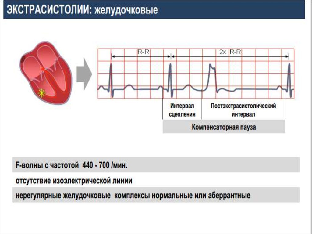 Сердечный восстановление. Нарушения ритма сердца презентация. Сердечный ритм доклад. Восстановить сердечный ритм в домашних. Точки восстанавливающие сердечный ритм.