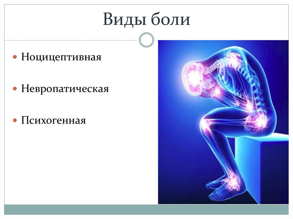 Вид болеть. Виды боли. Боль виды боли. Боль определение виды. Типы боли неврология.