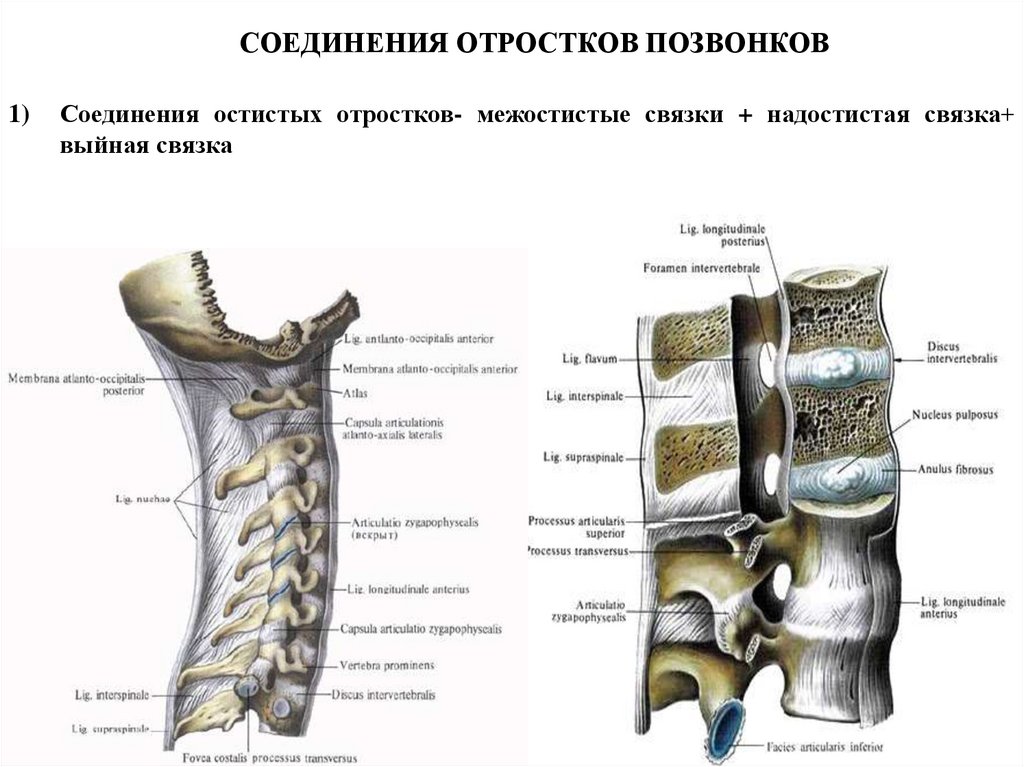 Соединения позвонков. Соединение костей туловища. Соединение костей туловища анатомия. Обызвествление выйной связки. Выйная связка позвоночника.