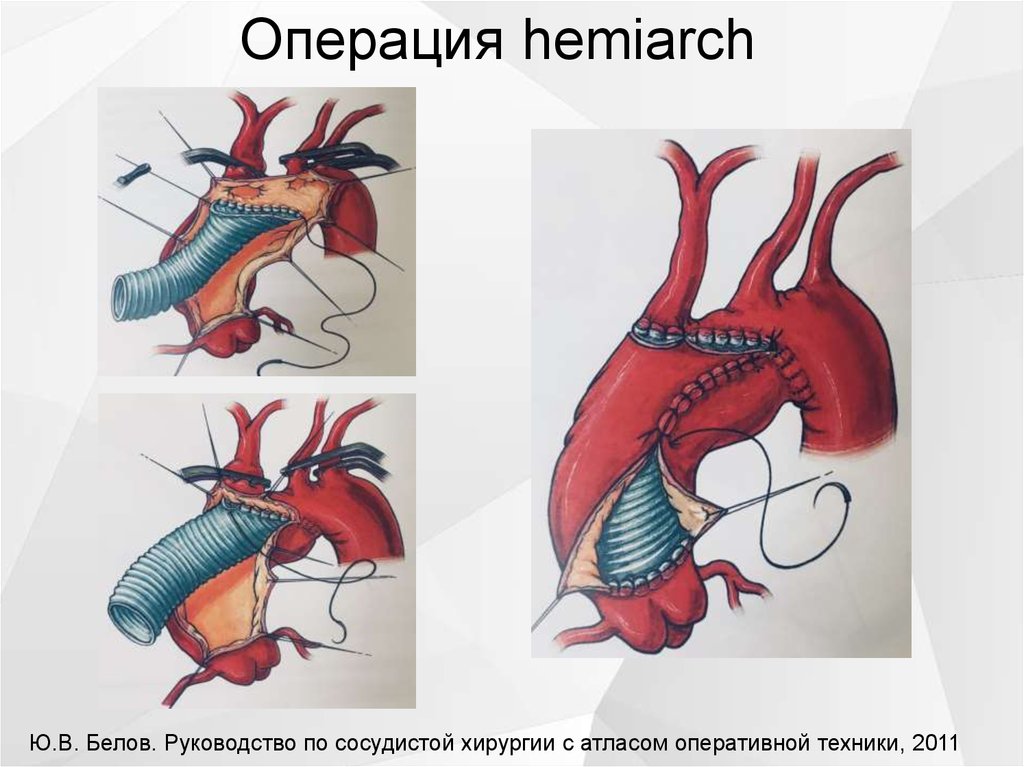 Дуги аорты позвоночных