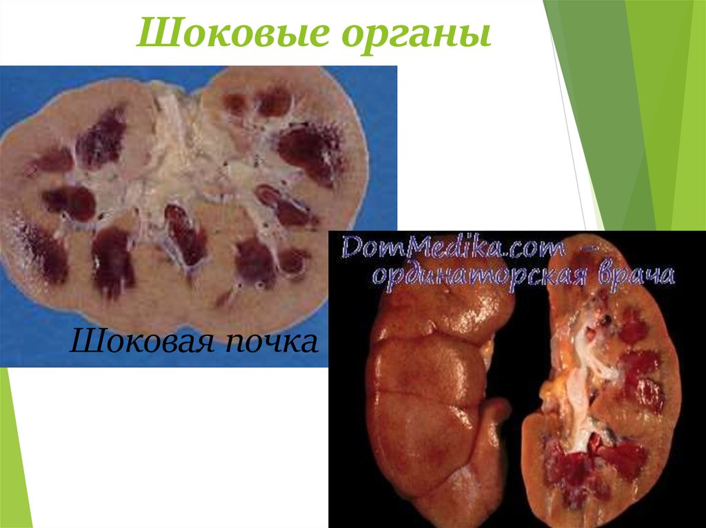 Шоковые органы