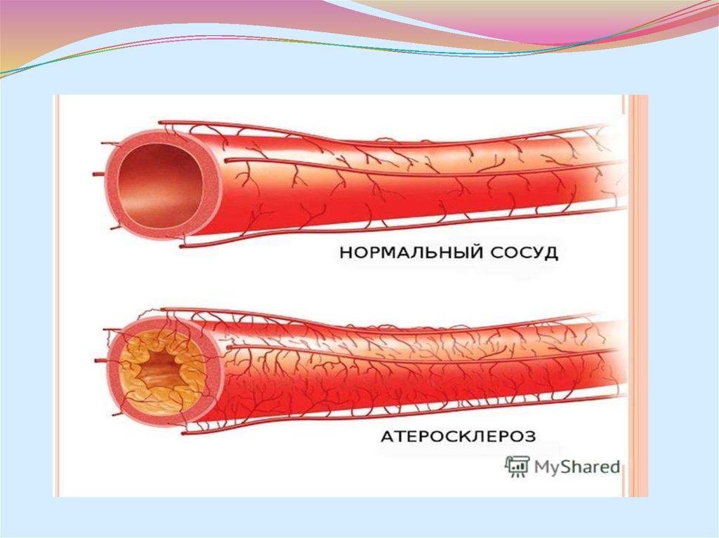Мышечный слой артерий и вен. Как выглядят капилляры вены и артерии. Венозная артерия.