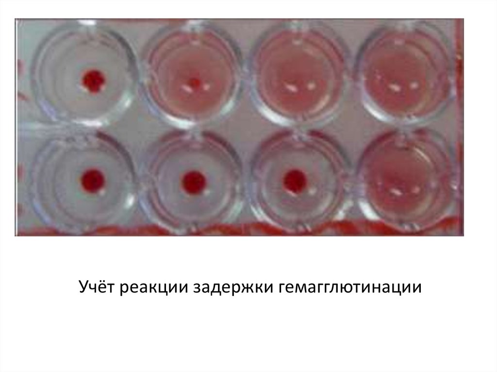 Реакция гемагглютинации. Реакция прямой гемагглютинации микробиология. Реакция задержки гемагглютинации в вирусологии. Реакция гемагглютинации иммунология. Реакция торможения непрямой гемагглютинации.