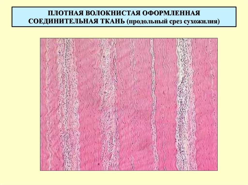Плотная оформленная ткань сухожилия. Плотная соединительная ткань гистология. Плотная волокнистая соединительная ткань сухожилия. Плотная волокнистая соединительная ткань гистология. Плотная волокнистая ткань гистология.