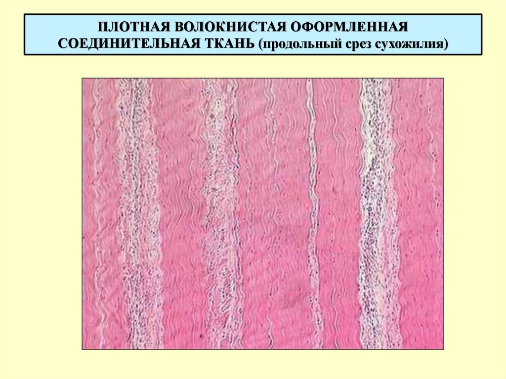 Плотная волокнистая ткань. Плотная оформленная волокнистая соединительная ткань. Плотная волокнистая соединительная ткань гистология. Плотная волокнистая ткань гистология. Оформленная волокнистая соединительная ткань сухожилие.