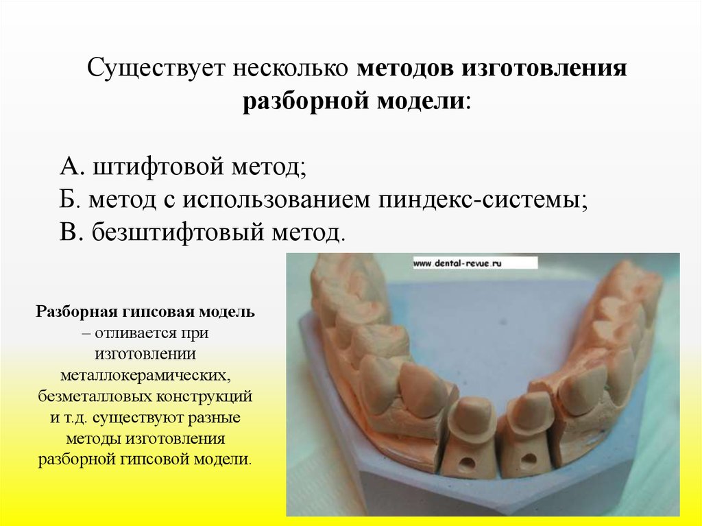 Методы изготовления разборной модели. Пиндекс система изготовления разборной модели. Изготовление разборной гипсовой модели. Комбинированная разборная гипсовая модель. Методы изготовление разборных моделей.