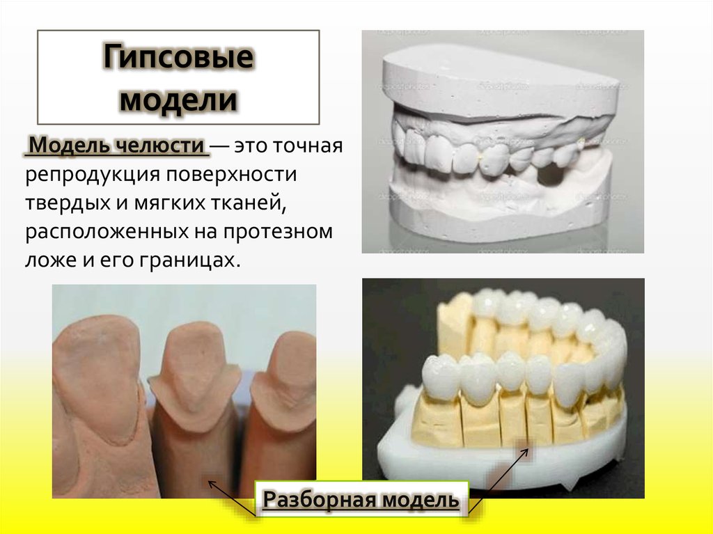 Проект на тему история гипса