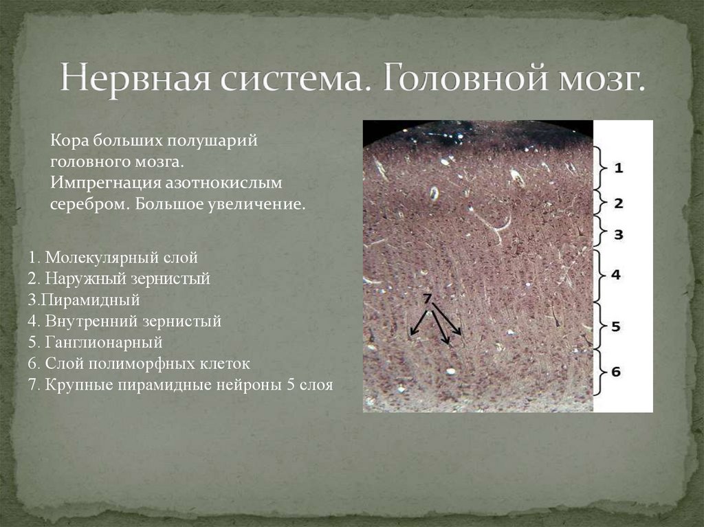 Головной мозг гистология презентация