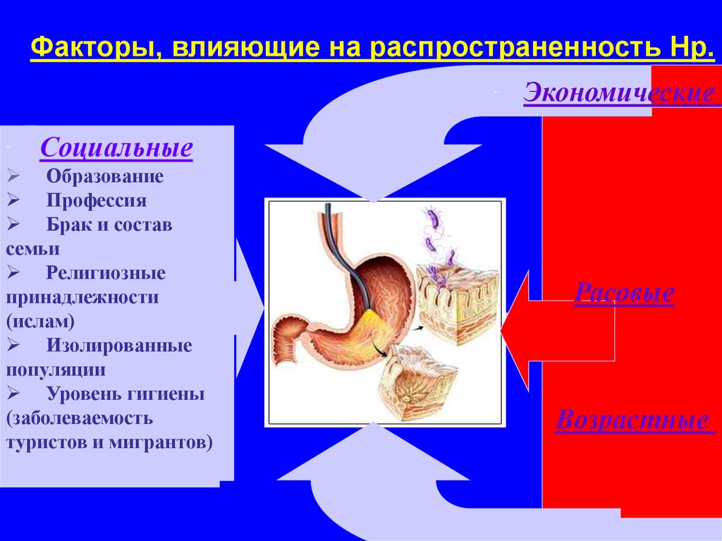 Профилактика язвенной болезни презентация