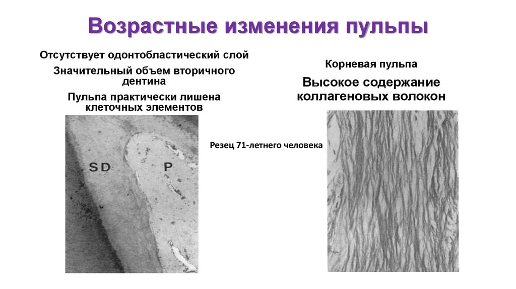 Возрастные изменения зубов презентация