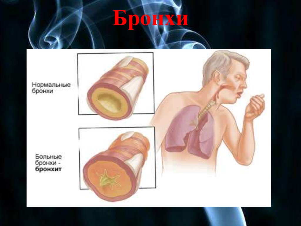 Презентация влияние курения на дыхательную систему