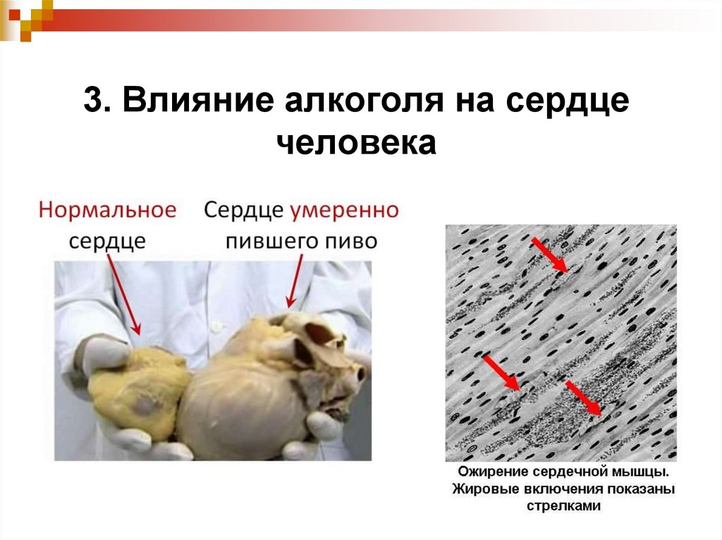 Гигиена сердечно сосудистой системы 8 класс презентация