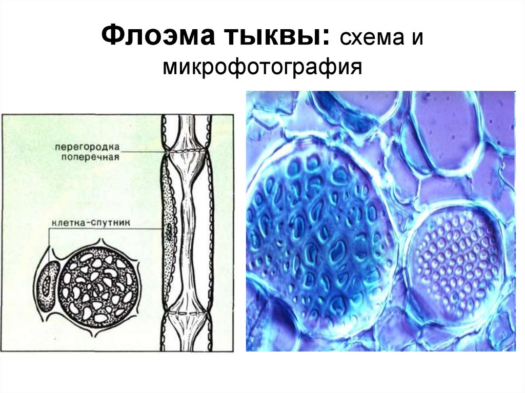Ситовидная клетка флоэмы. Флоэма растений под микроскопом. Флоэма микрофотография. Проводящая ткань. Проводящая ткань растений под микроскопом.
