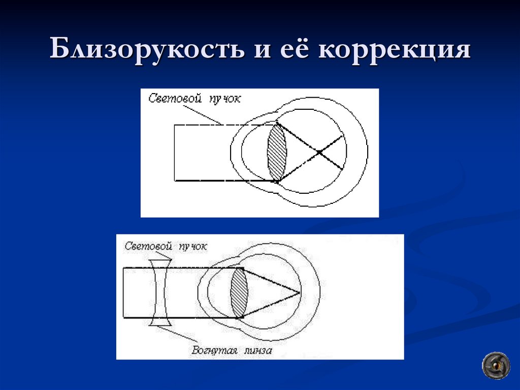 Презентация оптические приборы глаз